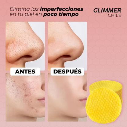 Almohadillas de Cúrcuma y Ácido Kójico Glimmer™ | Edición Limitada